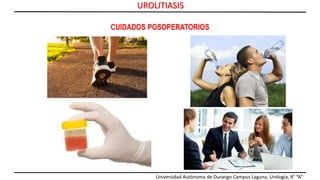Universidad Autónoma de Durango Campus Laguna, Urología, 9° “A”
UROLITIASIS
CUIDADOS POSOPERATORIOS
 