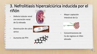 3. Nefrolitiasis hipercalciúrica inducida por el
riñón
• Defecto tubular renal
con excreción renal
de Ca elevada
• Disminución de calcio
sérico
• Aumento de PTH
• Mayor captación
Intestinal de Ca
• Concentraciones de
Ca de regreso al riñón
elevado
20
 