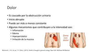 Dolor
• Es causado por la obstrucción urinaria
• Inicio abrupto
• Puede ser más o menos constante
• Algunos mecanismos que contribuyen a la intensidad son:
• Inflamación
• Edema
• Hiperperistalsis
• Irritación de la mucosa
McAninch, J. W., & Lue, T. F. (Eds.). (2013). Smith & Tanagho's general urology. New York: McGraw-Hill Medical.
 