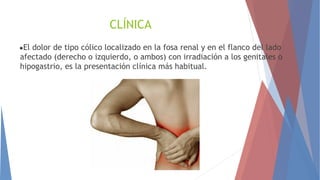CLÍNICA
●El dolor de tipo cólico localizado en la fosa renal y en el flanco del lado
afectado (derecho o izquierdo, o ambos) con irradiación a los genitales o
hipogastrio, es la presentación clínica más habitual.
 