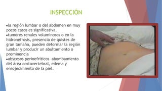 INSPECCIÓN
●la región lumbar o del abdomen en muy
pocos casos es significativa.
●tumores renales voluminosos o en la
hidronefrosis, presencia de quistes de
gran tamaño, pueden deformar la región
lumbar y producir un abultamiento o
prominencia
●abscesos perinefríticos  abombamiento
del área costovertebral, edema y
enrojecimiento de la piel.
 