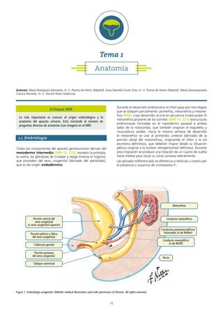 13
1.1. Embriología
Todos los componentes del aparato genitourinario derivan del
mesodermo intermedio (MIR 12, 210), excepto la próstata,
la uretra, las glándulas de Cowper y vejiga (menos el trígono),
que proceden del seno urogenital (derivado del alantoides),
que es de origen endodérmico.
Durante el desarrollo embrionario el riñón pasa por tres etapas
que se solapan parcialmente: pronefros, mesonefros y metane-
fros (MIR), cuyo desarrollo ocurre en secuencia crneocaudal. El
metanefros proviene de los somites (MIR 10, 223) (estructuras
embrionarias formadas en el mesodermo paraxial a ambos
lados de la notocorda), que también originan el esqueleto y
musculatura axiales. Hacia la novena semana de desarrollo
el metanefros se une al primordio ureteral (derivado de la
porción distal del mesonefros), originando el riñón y la vía
excretora definitivos, que deberán migrar desde su situación
pélvica original a la lumbar retroperitoneal definitiva. Durante
esta migración se produce una rotación de un cuarto de vuelta
hacia medial para situar su zona convexa lateralmente.
Las gónada indiferenciada se diferencia a testículo u ovario por
la presencia o ausencia de cromosoma Y.
Porción vesical del
seno urogenital
(o seno urogenital superior)
Porción pélvica y fálica
del seno urogenital
Conductos paramesonéfricos
fusionados (o de Müller)
Conducto mesonéfrico
(o de Wolff)
Porción peneana
del seno urogenital
Tubérculo genital
Metanefros
Recto
Tabique urorrectal
Conducto metanéfrico
Figura 1. Embriología urogenital. ©Netter medical illustration used with permission of Elsevier. All rights reserved.
Autores: María Rodríguez-Monsalve, H. U. Puerta de Hierro (Madrid). Aura Daniella Souto Soto, H. U. Puerta de Hierro (Madrid). María Desamparados
Cuenca Ramírez, H. U. Doctor Peset (Valencia).
Anatomía
Tema 1
Enfoque MIR
Lo más importante es conocer el origen embriológico y la
anatomía del aparato urinario. Está creciendo el número de
preguntas directas de anatomía (con imagen) en el MIR.
 