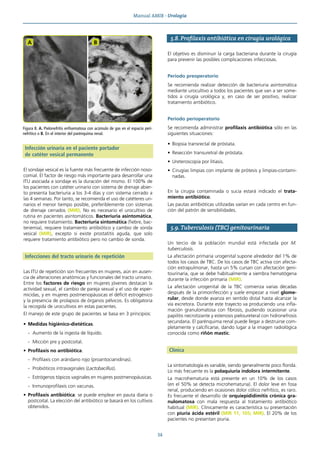 Manual AMIR · Urología
34
Infección urinaria en el paciente portador
de catéter vesical permanente
El sondaje vesical es la fuente más frecuente de infección noso-
comial. El factor de riesgo más importante para desarrollar una
ITU asociada a sondaje es la duración del mismo. El 100% de
los pacientes con catéter urinario con sistema de drenaje abier-
to presenta bacteriuria a los 3-4 días y con sistema cerrado a
las 4 semanas. Por tanto, se recomienda el uso de catéteres uri-
narios el menor tiempo posible, preferiblemente con sistemas
de drenaje cerrados (MIR). No es necesario el urocultivo de
rutina en pacientes asintomáticos. Bacteriuria asintomática,
no requiere tratamiento. Bacteriuria sintomática (fiebre, bac-
teriemia), requiere tratamiento antibiótico y cambio de sonda
vesical (MIR), excepto si existe prostatitis aguda, que solo
requiere tratamiento antibiótico pero no cambio de sonda.
Infecciones del tracto urinario de repetición
Las ITU de repetición son frecuentes en mujeres, aún en ausen-
cia de alteraciones anatómicas y funcionales del tracto urinario.
Entre los factores de riesgo en mujeres jóvenes destacan la
actividad sexual, el cambio de pareja sexual y el uso de esper-
micidas, y en mujeres postmenopáusicas el déficit estrogénico
y la presencia de prolapsos de órganos pélvicos. Es obligatoria
la recogida de urocultivos en estas pacientes.
El manejo de este grupo de pacientes se basa en 3 principios:
• Medidas higiénico-dietéticas.
- Aumento de la ingesta de líquido.
- Micción pre y postcoital.
• Profilaxis no antibiótica.
- Profilaxis con arándano rojo (proantocianidinas).
- Probióticos intravaginales (Lactobacillus).
- Estrógenos tópicos vaginales en mujeres postmenopáusicas.
- Inmunoprofilaxis con vacunas.
• Profilaxis antibiótica: se puede emplear en pauta diaria o
postcoital. La elección del antibiótico se basará en los cultivos
obtenidos.
5.8. Profilaxis antibiótica en cirugía urológica
El objetivo es disminuir la carga bacteriana durante la cirugía
para prevenir las posibles complicaciones infecciosas.
Periodo preoperatorio
Se recomienda realizar detección de bacteriuria asintomática
mediante urocultivo a todos los pacientes que van a ser some-
tidos a cirugía urológica y, en caso de ser positivo, realizar
tratamiento antibiótico.
Periodo perioperatorio
Se recomienda administrar profilaxis antibiótica sólo en las
siguientes situaciones:
• Biopsia transrectal de próstata.
• Resección transuretral de próstata.
• Ureteroscopia por litiasis.
• Cirugías limpias con implante de prótesis y limpias-contami-
nadas.
En la cirugía contaminada o sucia estará indicado el trata-
miento antibiótico.
Las pautas antibióticas utilizadas varían en cada centro en fun-
ción del patrón de sensibilidades.
5.9. Tuberculosis (TBC) genitourinaria
Un tercio de la población mundial está infectada por M.
tuberculosis.
La afectación primaria urogenital supone alrededor del 1% de
todos los casos de TBC. De los casos de TBC activa con afecta-
ción extrapulmonar, hasta un 5% cursan con afectación geni-
tourinaria, que se debe habitualmente a siembra hematógena
durante la infección primaria (MIR).
La afectación urogenital de la TBC comienza varias décadas
después de la primoinfección y suele empezar a nivel glome-
rular, desde donde avanza en sentido distal hasta alcanzar la
vía excretora. Durante este trayecto va produciendo una infla-
mación granulomatosa con fibrosis, pudiendo ocasionar una
papilitis necrotizante y estenosis pieloureteral con hidronefrosis
secundaria. El parénquima renal puede llegar a destruirse com-
pletamente y calcificarse, dando lugar a la imagen radiológica
conocida como riñón mastic.
Clínica
La sintomatología es variable, siendo generalmente poco florida.
Lo más frecuente es la polaquiuria indolora intermitente.
La macrohematuria está presente en un 10% de los casos
(en el 50% se detecta microhematuria). El dolor leve en fosa
renal, produciendo en ocasiones dolor cólico nefrítico, es raro.
Es frecuente el desarrollo de orquiepididimitis crónica gra-
nulomatosa con mala respuesta al tratamiento antibiótico
habitual (MIR). Clínicamente es característica su presentación
con piuria ácida estéril (MIR 11, 105; MIR). El 20% de los
pacientes no presentan piuria.
Figura 8. A. Pielonefritis enfisematosa con acúmulo de gas en el espacio peri-
nefrítico o B. En el interior del parénquima renal.
A B
 