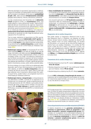 Manual AMIR · Urología
48
diferentes abordajes (cirugía abierta, laparoscópica o robótica),
ninguno ha mostrado una superioridad en términos de resulta-
dos funcionales ni oncológicos. En los casos con probabilidad
de pN+ >5%, debe asociarse linfadenectomía extendida
(ganglios iliacos externos, internos, obturatrices y presacros).
Las dos complicaciones más frecuentes son la disfunción
eréctil iatrogénica (75%) y la incontinencia (20%), que
puede deberse a varias alteraciones locales: hipercontracti-
lidad del detrusor (incontinencia de urgencia), hipocontrac-
tilidad del mismo (incontinencia por rebosamiento) o lesión
del esfínter vesical (incontinencia de esfuerzo) (MIR 12, 110).
En un intento por disminuir su incidencia, se ha descrito la
preservación de los haces neurovasculares, que está con-
traindicado en pacientes con alto riesgo de extensión extra-
capsular (cT2c-T3 o ISUP >3).
Tras la cirugía, realizamos un seguimiento con PSA, que de-
bería descender y hacerse indetectable (<0,01 ng/mL). En
ocasiones, tras un descenso inicial, se produce un ascenso por
encima de 0,2 ng/mL en dos determinaciones consecutivas,
lo que denominamos recidiva bioquímica y puede traducir
una progresión local de la enfermedad y/o metástasis sisté-
micas (MIR).
• Radioterapia externa radical: se recomienda RT de inten-
sidad modulada (IMRT) a una dosis de 74-80 Gy. En caso de
riesgo intermedio y alto debe asociarse hormonoterapia du-
rante 6 meses y 2-3 años, respectivamente. Ofrece un control
oncológico similar a la cirugía. Una diferencia importante es
que los efectos secundarios no aparecen de forma inmediata,
como ocurre en la cirugía, sino que pueden aparecer meses o
años después del tratamiento, e incluyen, además de disfunción
eréctil e incontinencia urinaria, cistitis, rectitis o proctitis rádica.
De forma análoga a la cirugía, el PSA tras la radioterapia debe
descender, pero lo hace más lentamente y sin que exista un
valor objetivo. Se define la recidiva bioquímica como un
aumento de PSA por encima de 2 ng/mL sobre el nivel más
bajo obtenido tras el tratamiento (denominado PSA nadir).
De igual forma, puede traducir una progresión local de la
enfermedad y/o metástasis sistémicas.
• Radioterapia interna = braquiterapia. La braquiterapia es
una alternativa a la IMRT. Consiste en la colocación en la
próstata (por vía transperineal, guiado ecográficamente) de
semillas permanentes de I125. Debido a que puede producir
síntomas del tracto urinario inferior similares a los que pro-
duce la HBP, no debe indicarse en aquellos pacientes con
RTUP previa, una puntuación alta del IPSS o un volumen pros-
tático ≥ 50 cc.
• Otras modalidades de tratamiento. En el tratamiento del
CP localizado se han propuesto otras modalidades terapéuti-
cas como la crioterapia o el ultrasonido focal de alta in-
tensidad (HIFU), si bien deben actualmente deben ofrecerse
exclusivamente en el contexto de ensayos clínicos.
Una situación particular es el CP localmente avanzado. El
tratamiento debe ser individualizado y todavía no está es-
tandarizado. La combinación de radioterapia + hormo-
noterapia ha demostrado ser una opción eficaz. En casos
seleccionados, la prostatectomía, como parte de un trata-
miento multimodal (PR + linfadenectomía seguida de
RT), es una alternativa.
Diagnóstico de la recidiva bioquímica
Para poder realizar un diagnóstico diferencial entre la reci-
diva bioquímica local y a distancia, nos basamos en datos
clínicos: tiempo hasta la recidiva, velocidad de elevación del
PSA y Gleason inicial. Un tumor indiferenciado, con recidiva
de PSA precoz y un aumento de las cifras de PSA rápido nos
orienta hacia una recidiva metastásica. Si la recidiva de PSA
ocurre a partir de 10-12 meses y la elevación es lenta, nos
indica que probablemente estemos ante una recidiva local.
Adicionalmente, realizamos una prueba de imagen (PET-
PSMA o PET-colina) y, en el caso de recidiva tras RT, además
una RMmp y una biopsia prostática dirigida para confirmar
la recidiva local.
Tratamiento de la recidiva bioquímica
• Recidiva bioquímica local tras PR: realizar radioterapia ex-
terna de rescate.
• Recidiva bioquímica local tras RT: tras confirmación histoló-
gica (con biopsia), realizar PR de rescate.
• Recidiva bioquímica a distancia tras PR o RT: ofrecer castración.
El uso de HIFU, crioterapia y braquiterapia de rescate en el
tratamiento de la recidiva bioquímica local todavía se conside-
ran tratamientos experimentales, por lo que no se recomienda
su uso más allá de un ensayo clínico.
Tratamiento sistémico
El CP puede escapar de su confinamiento orgánico por extensión
local, al infiltrar los tejidos extraprostáticos adyacentes, así como
por infiltración linfática de las estructuras ganglionares cercanas.
Una vez alcanzados los ganglios locorregionales, se produce una
diseminación linfática a distancia y a vísceras por vía hematóge-
na. El CP tiene una elevada afinidad por metastatizar el tejido
óseo (MIR 10, 98). La presencia de metástasis contraindica el
empleo de tratamientos locales con intención curativa.
Cáncerdepróstatahormonosensiblemetastásico(CPHSM1)
El objetivo terapéutico en los pacientes asintomáticos es
aumentar la supervivencia, diferir la progresión a una
etapa sintomática y prevenir complicaciones graves rela-
cionadas con la progresión de la enfermedad (compresión de
la médula espinal, fracturas patológicas, obstrucción ureteral).
En caso de pacientes sintomáticos, el objetivo es paliar los
síntomas y prevenir complicaciones graves relacionadas
con la progresión de la enfermedad.
Figura 3. Braquiterapia de la próstata.
 