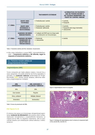 Manual AMIR · Urología
58
• Alta carga metastásica o grupo IMDC intermedio/desfavo-
rable → tratamiento sistémico ± NC diferida, según la
respuesta al tratamiento sistémico.
11.2. Tumores renales sólidos de
comportamiento benigno
Angiomiolipoma (AML)
Tumor compuesto por tejido adiposo maduro, músculo liso y
vasos sanguíneos. Se puede presentar de forma esporádica o
asociado a la esclerosis tuberosa (enfermedad de Pringle-
Bourneville) (MIR) (retraso mental, epilepsia, adenomas sebá-
ceos y angiomiolipomas múltiples).
(Ver figuras 4 y 5)
El síntoma más grave es la hemorragia retroperitoneal espon-
tanea (síndrome de Wünderlich) que produce dolor lumbar,
repercusión hemodinámica y ocasionalmente hematuria. La
mayoría de los AML no requieren tratamiento. Sólo se reco-
mienda tratarlos (con embolización arterial selectiva o nefrec-
tomía) en:
AML
ESPORÁDICO
AML ASOCIADO A
ESCLEROSIS TUBEROSA
50% 50%
Gran tamaño Pequeño
Único, unilateral Múltiple, bilateral
Sintomático Asintomático
Tabla 3. Formas de presentación del AML.
Figura 4. Angiomiolipoma renal en la ecografía.
Figura 5. Histología del angiomiolipoma renal. Se observa el componente lipídi-
co (A), vascular (B) y muscular (C).
TRATAMIENTO ESTÁNDAR
ALTERNATIVAS EN PACIENTES
QUE NO PUEDEN RECIBIR O
NO TOLERAN INHIBIDORES DEL
PUNTO DE CONTROL INMUNE
1.ª LÍNEA
GRUPO IMDC
FAVORABLE
• Pembrolizumab / axitinib. • Sunitinib.
• Pazopanib.
GRUPO IMDC
INTERMEDIO O
DESFAVORABLE
• Pembrolizumab / axitinib.
• Nivolumab / ipilimumab.
• Sunitinib..
• Pazopanib (solo riesgo intermedio).
• Cabozantinib.
2.ª LÍNEA
HABIENDO RECIBIDO
INMUNOTERAPIA
• Cualquier anti-VEGF que no se haya usado
en combinación con inmunoterapia.
HABIENDO RECIBIDO
INHIBIDORES DE
RECEPTORES DE
TIROSIN-KINASA
• Nivolumab.
• Cabozantinib.
• Axitinib.
Tabla 2. Tratamiento sistémico del CRcc metastásico. Secuenciación.
 