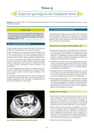 65
13.1. Consideraciones técnicas
El injerto puede obtenerse mediante extracción multiorgánica
o sólo renal, conservándose en frío hasta su implante.
El riñón se implanta en una de las fosas ilíacas mediante una
incisión en palo de golf o de Gibson (aunque pueden exis-
tir otras localizaciones en caso de imposibilidad técnica) sin
nefrectomía de los riñones nativos quedando extraperitoneal.
Se realiza una anastomosis terminolateral de la arteria y vena
renales a la arteria y vena ilíacas externas (aunque es posible
realizar la anastomosis a otros vasos) y un implante del uréter
a la vejiga. Se deja un drenaje en el lecho quirúrgico y una
sonda vesical.
El control postoperatorio se realiza con medición estricta de
la diuresis, determinaciones periódicas de creatinina y hema-
tocrito, control vascular mediante ecografía Doppler en las
primeras 48 h.
El tratamiento inmunosupresor de por vida es fundamental
para disminuir el rechazo del injerto. Los principales inmunosu-
presores empleados son los corticoides, el micofenolato y el
tacrolimus (inhibidor de la calcineurina).
13.2. Complicaciones quirúrgicas
La tasa global de complicaciones oscila del 1-25%. No existen
descritas variables predictoras de complicación en el donante
ni en el receptor. Los pacientes con complicaciones quirúrgicas
presentan peor tasa de supervivencia del injerto respecto a los
que no presentan complicaciones.
Complicaciones vasculares (6-30%) (MIR 18, 133)
• Estenosis de la arteria renal: es la complicación más frecuente
(1-23%). Ocurre de forma tardía y se caracteriza por la pre-
sencia de deterioro de la función renal e hipertensión arterial
refractaria. Su diagnóstico se realiza mediante angiografía,
angioTC o ecografía Doppler. El tratamiento se basa en la
angioplastia o cirugía en casos refractarios.
• Trombosis de la arteria renal: es la complicación menos fre-
cuente y se caracteriza por signos de infarto renal como dolor
en el área del injerto, elevación de la LDH y ausencia de flujo
con evidencia de trombosis arterial en la ecografía Doppler.
Su tratamiento es la fibrinólisis.
• Trombosis de la vena renal: disfunción del injerto con ausencia
de flujo venoso y aumento del tamaño renal en la ecografía.
Es un factor ominoso de supervivencia del injerto evolucio-
nando en la mayoría de los casos de forma desfavorable.
• Hemorragia postoperatoria (MIR): complicación inmediata
postoperatoria caracterizada por signos de shock hipovolé-
mico (taquicardia, palidez mucocutánea, hipotensión arterial)
con aumento del débito por el drenaje de aspecto hemático.
El diagnóstico de confirmación se basa en la TC abdomino-
pélvica y el tratamiento es la cirugía.
Complicaciones urológicas
• Estenosis de la anastomosis ureterovesical: puede ser inme-
diata o diferida. Se manifiesta por deterioro de la función
renal con dilatación de la vía urinaria en la ecografía. El
tratamiento es la derivación urinaria mediante nefrostomía
percutánea y resolución quirúrgica posterior. En los casos de
estenosis precoces se puede optar por la cirugía inmediata.
• Fístula ureteral: suele ocasionarse por problemas en la anas-
tomosis o isquemia ureteral. El diagnóstico de sospecha se
basa en la salida de orina por el drenaje o la herida quirúr-
gica. El diagnóstico de localización es la TC-urografía y su
tratamiento es la derivación urinaria mediante nefrostomía y
reparación quirúrgica posterior. En el caso de fístulas preco-
ces el tratamiento quirúrgico es la primera opción.
• Otras: litiasis, reflujo vesicoureteral.
Figura 1. Riñón trasplantado colocado en la fosa ilíaca derecha.
Aspectos quirúrgicos del trasplante renal
Tema 13
Autores: Bernat Padullés Castelló, H. Clínic (Barcelona). María Rodríguez-Monsalve, H. U. Puerta de Hierro (Madrid). Elena Masana Flores, H. U. Virgen
de las Nieves (Granada).
Enfoque MIR
Este tema se limita a los aspectos quirúrgicos del trasplante renal.
Con una lectura por encima es suficiente. Se debe completar con
los aspectos médicos del trasplante renal, explicados en el manual
de Nefrología (MIR 10, 97).
 