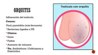 Testitis Comprehensive Overview of Epididymal, Testicular, Scrotal, and Penile ...