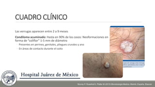 CUADRO CLÍNICO
Las verrugas aparecen entre 2 a 9 meses
Condiloma acuminado: Hasta en 90% de los casos: Neoformaciones en
forma de “coliflor” 1-5 mm de diámetro
◦ Presentes en perineo, genitales, pliegues crurales y ano
◦ En áreas de contacto durante el coito
Murray P, Rosethal K, Pfaller M (2013) Microbiologia Medica. Madrid, España. Elsevier
 