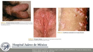 Kasper D. Hauser S, Jameson J, Fauci A, Longo D, Loscalzo J. (2015) HARRISON. Principios de medicina interna.
Ciudad de México. Elsevier. pp: 1678-1681
 