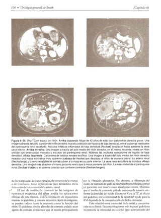 Urologia smith 11_ed