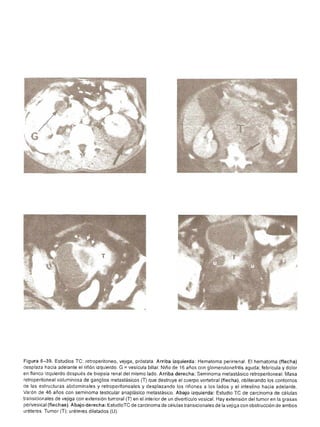 Urologia smith 11_ed