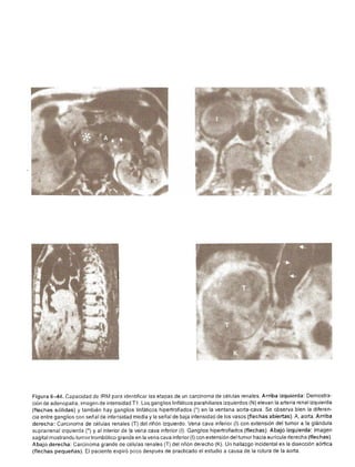Urologia smith 11_ed