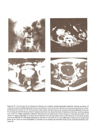 Urologia smith 11_ed