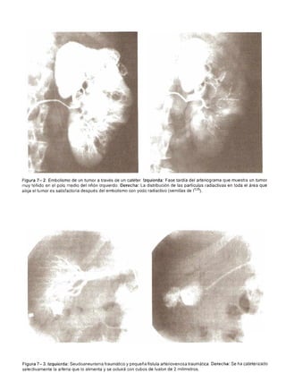 Urologia smith 11_ed