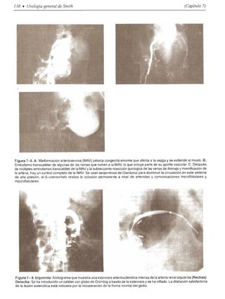 Urologia smith 11_ed