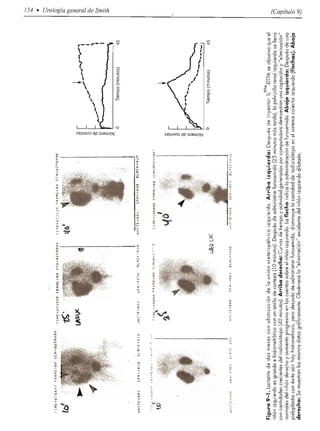 Urologia smith 11_ed