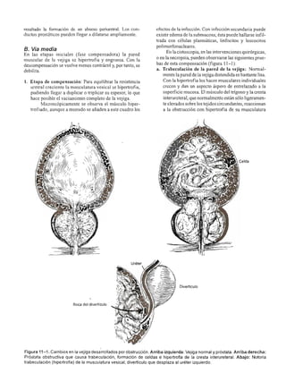 Urologia smith 11_ed