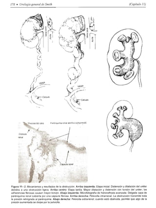 Urologia smith 11_ed