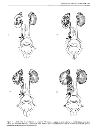 Urologia smith 11_ed