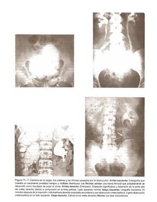 Urologia smith 11_ed