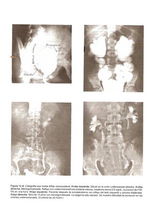 Urologia smith 11_ed