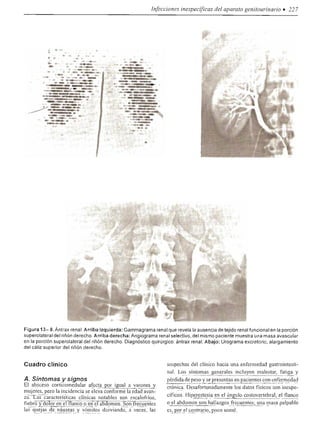 Urologia smith 11_ed