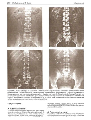Urologia smith 11_ed