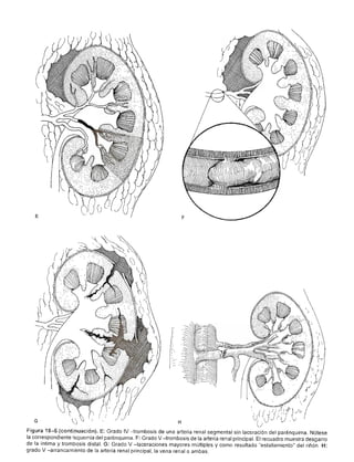 Urologia smith 11_ed