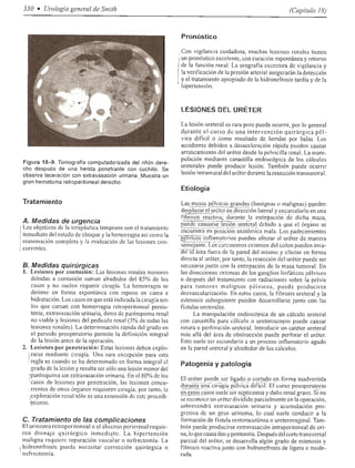 Urologia smith 11_ed