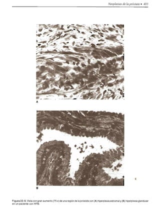 Urologia smith 11_ed