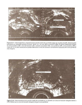 Urologia smith 11_ed
