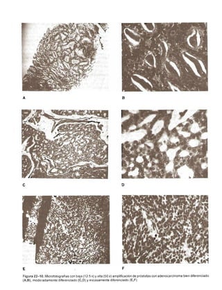 Urologia smith 11_ed