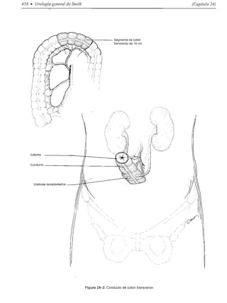 Urologia smith 11_ed