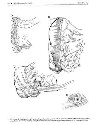 Urologia smith 11_ed
