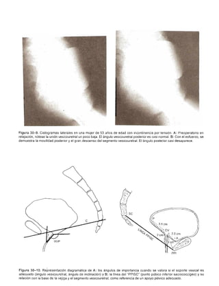 Urologia smith 11_ed