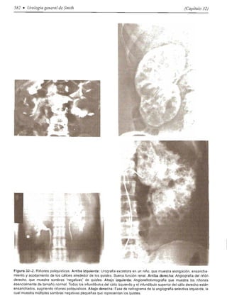 Urologia smith 11_ed