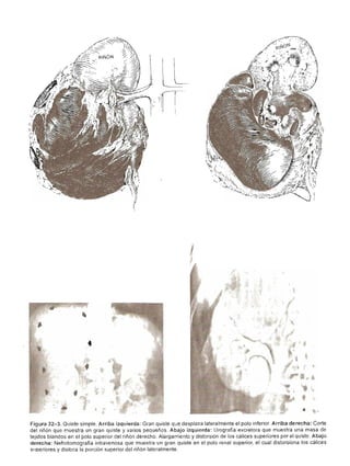 Urologia smith 11_ed
