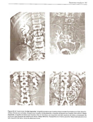 Urologia smith 11_ed