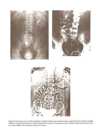 Urologia smith 11_ed