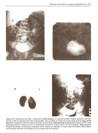 Urologia smith 11_ed