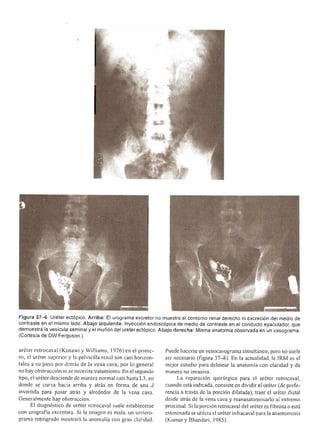 Urologia smith 11_ed