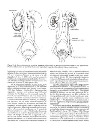 Urologia smith 11_ed