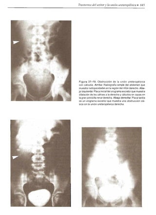 Urologia smith 11_ed