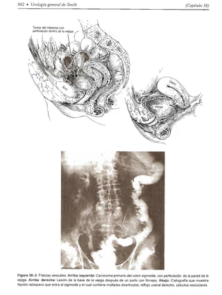 Urologia smith 11_ed