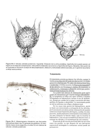 Urologia smith 11_ed