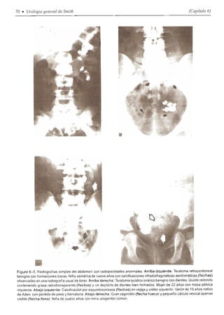 Urologia smith 11_ed