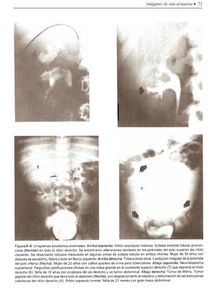 Urologia smith 11_ed