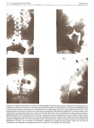 Urologia smith 11_ed