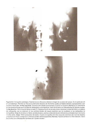 Urologia smith 11_ed