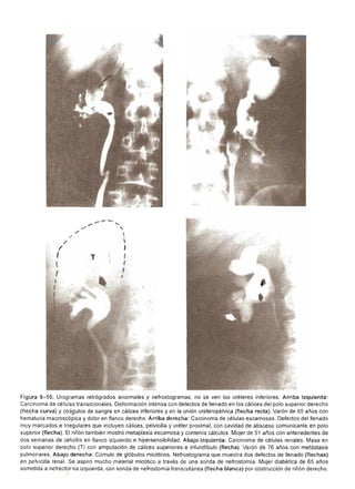 Urologia smith 11_ed